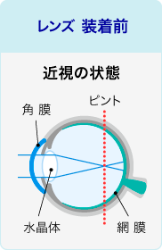 レンズ装着前